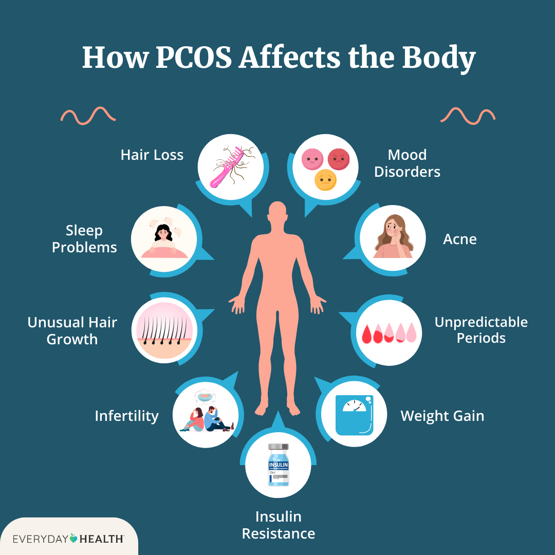 Impact of PCOS Image